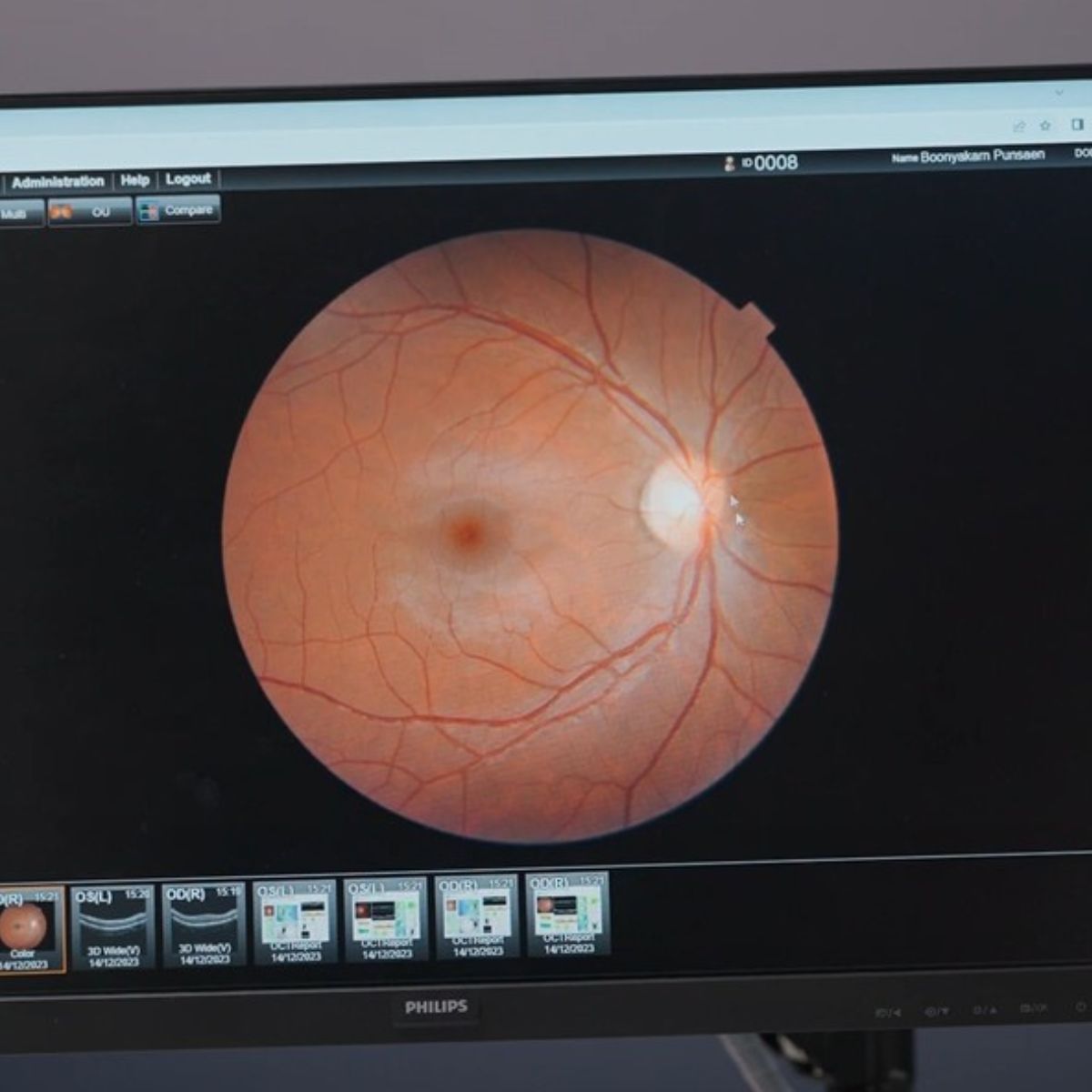 eye_health_check